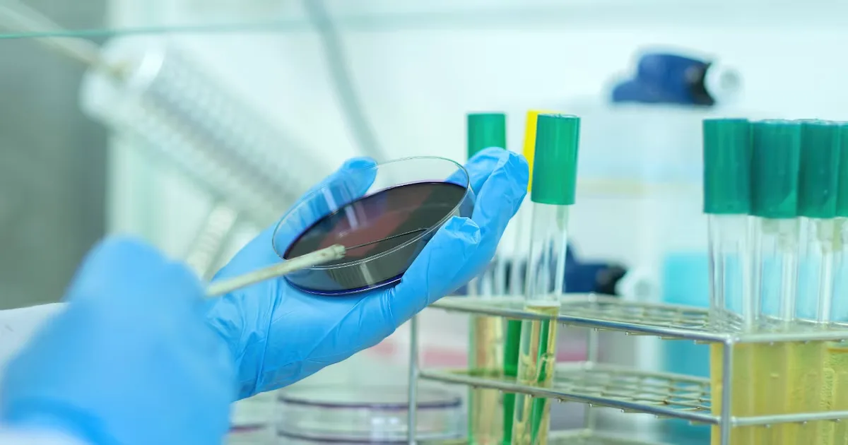 Teste imunocromatográfico acelera detecção de superbactérias em UTIs
